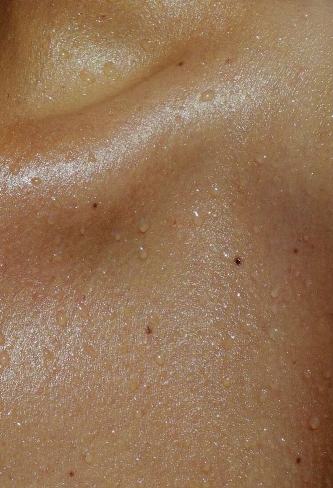 Épilation laser diode — cure laser douceur Adriaesthetic